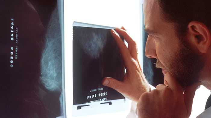 Pinpointed Breast Cancer Genes Explain why some Cases are so hard to beat
internetmedicine.com/2016/05/11/498…