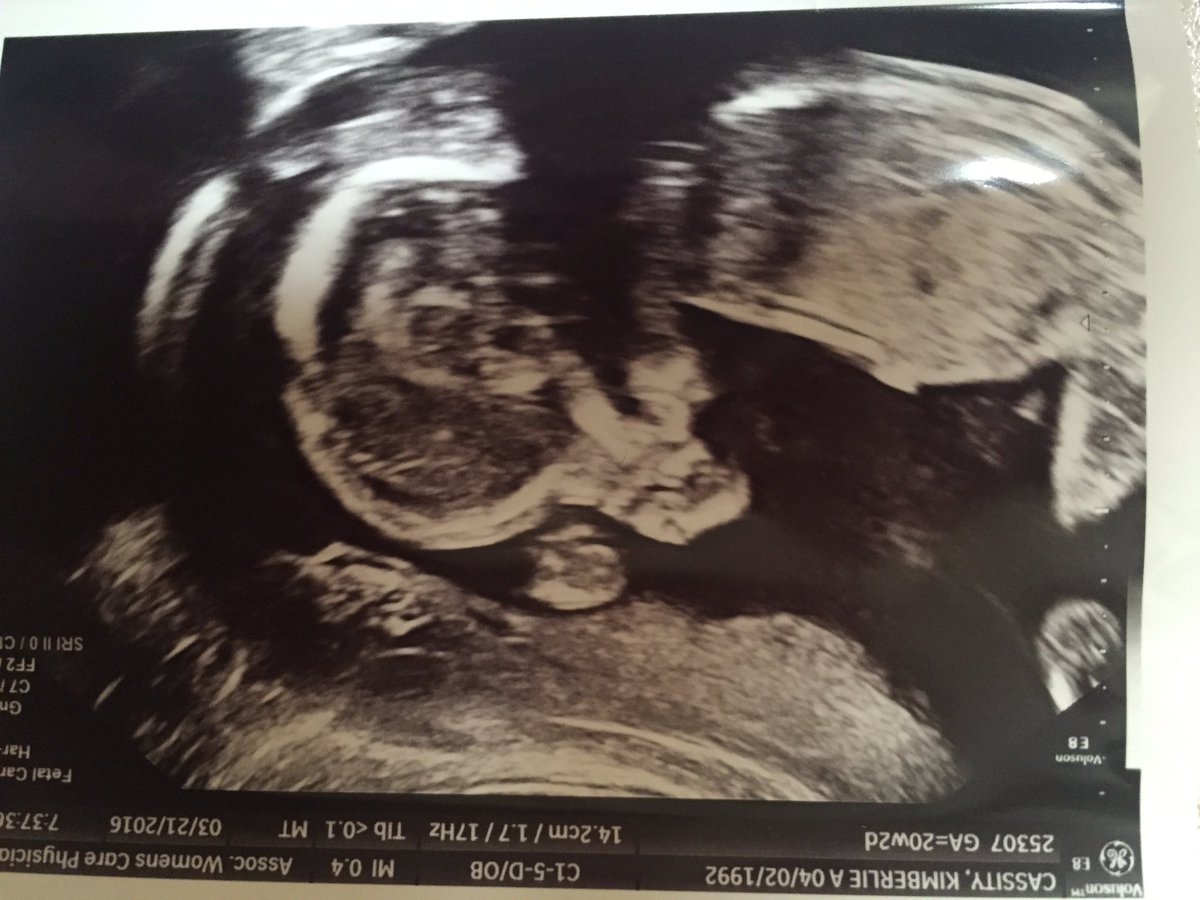kimacassity's tweet photo. Well in case you haven't heard...We are expecting a new little guy in August! Thanks team for a great LBE shower! https://t.co/HpkVhOjiYI