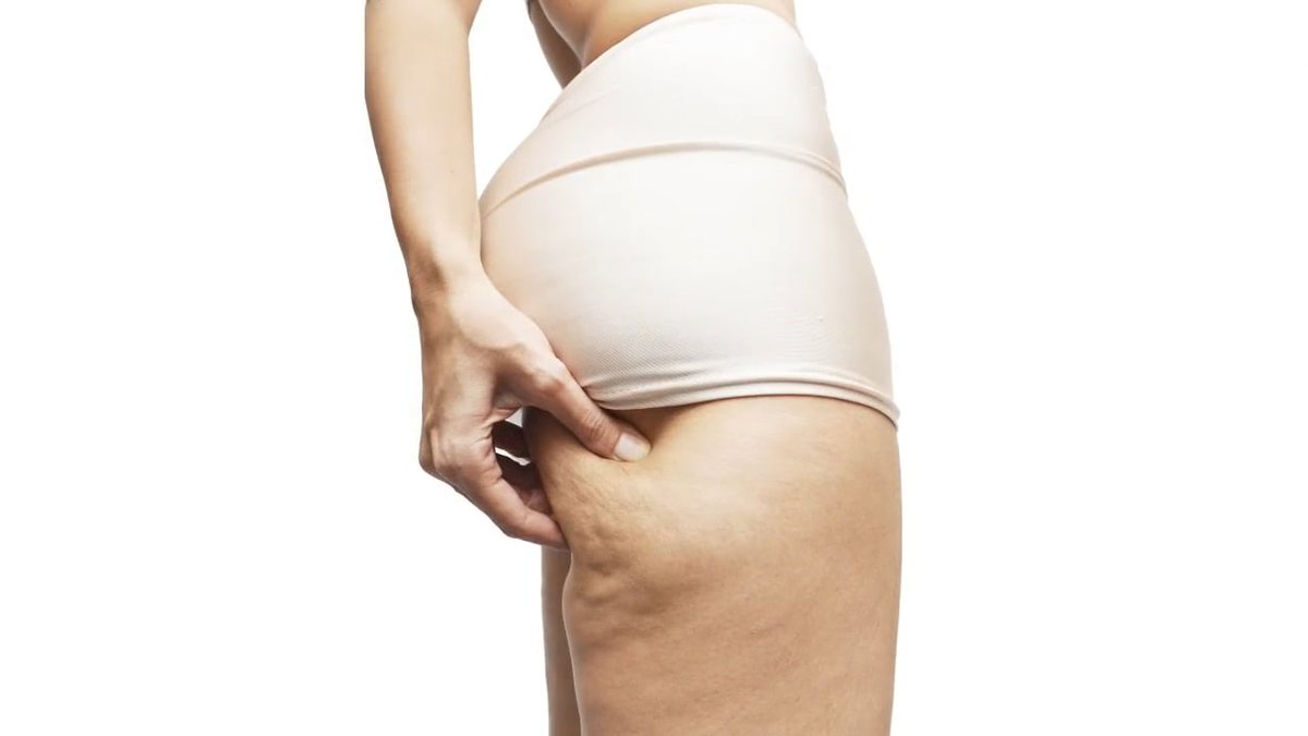 BioslimmingES's tweet photo. #Bioslimming trata 3 componentes de la #celulitis https://t.co/swq0iD2wPj
#redefinetuscurvas #byebyecelulitis https://t.co/mPduVrVZAM