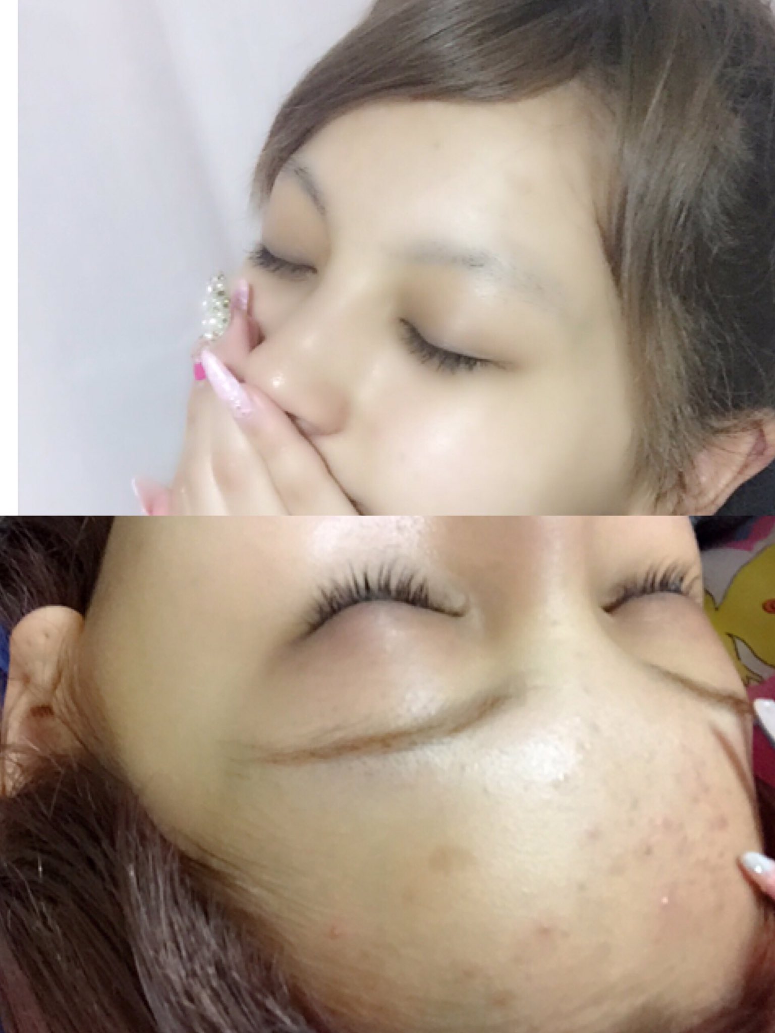 ゆきぽよ Yuki Kimura Pa Twitter 8本目突入 前髪あると必ずおデコにニキビ できる体質だったけど今は本格的に使い始めて1年1ヶ月目 前髪あってもニキビできないしニキビ跡も無くなった メディプラスだけは胸はっておすすめ T Co Vrfsoa1nbk ゆきぽよ Yuki Kimura Pa Twitter 8本目突入 前髪あると必ずおデコにニキビ できる体質だったけど今は本格的に使い始めて1年1ヶ月目 前髪あってもニキビできないしニキビ跡も無くなった メディプラスだけは胸はっておすすめ T Co Vrfsoa1nbk