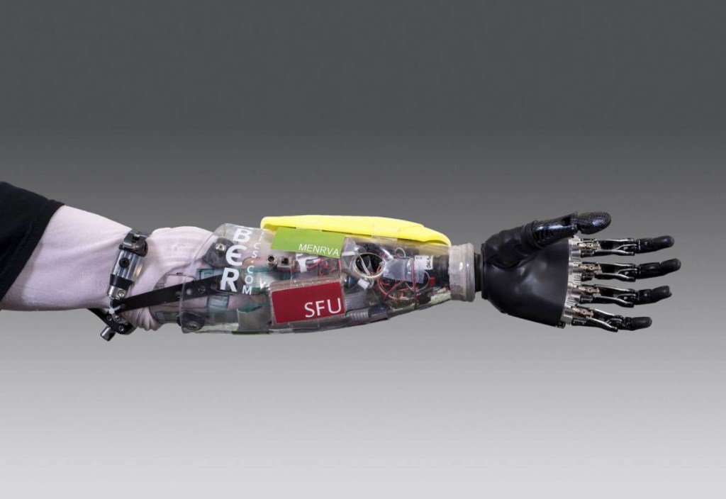 RobotsES's tweet image. La Robótica y la Medicina 1 robotses.wordpress.com/2016/05/12/la-…