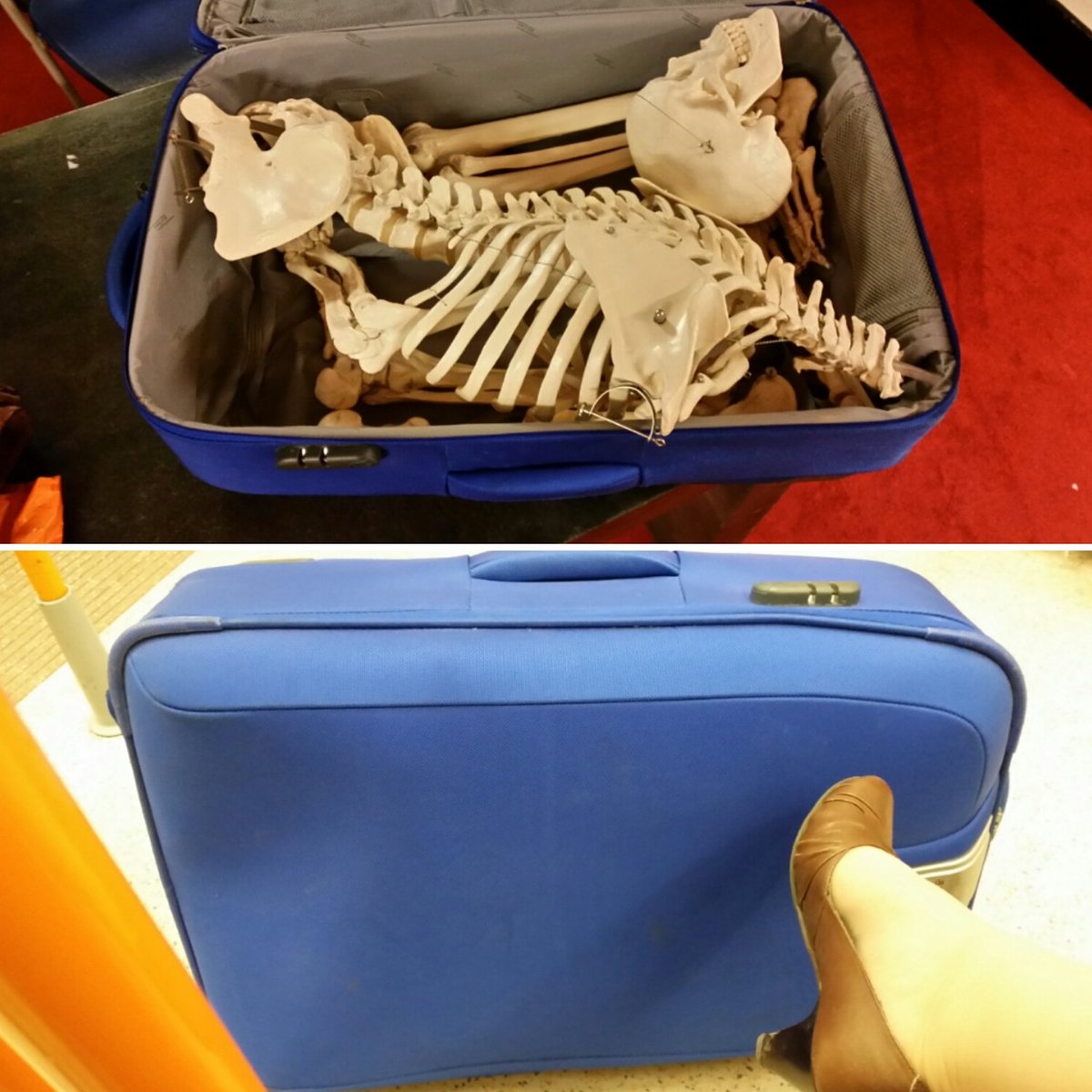 NunheadOsteo's tweet image. Wondering what fellow commuters would think about the contents of my suitcase #itsnotreal #osteopath #teachingprops