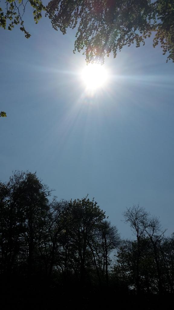 Volteral's tweet photo. #Sunburn #UV #Scotland #BlueWhiteSkin to #RedSkin remember your #HighFactor #SunCream πππππ from #Helimed76 https://t.co/4Dazw3dtfc