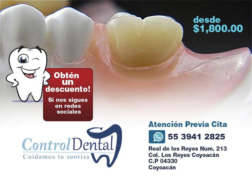 Prótesis dentales? Opción funcional y estética. Recupera tu mordida facebook.com/ControlDental.… @VendoCDMX <a href="/VentasenelDF/">Ventas En El DF</a>