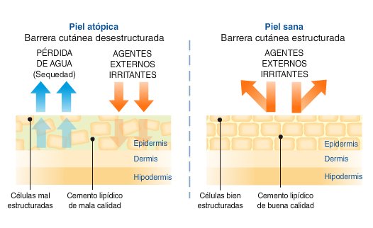 CCpharma_BCN's tweet photo. ¿Piel atópica? Lee este interesante enlace!  https://t.co/wTmCNvVTMY https://t.co/3B3ElPKYPI