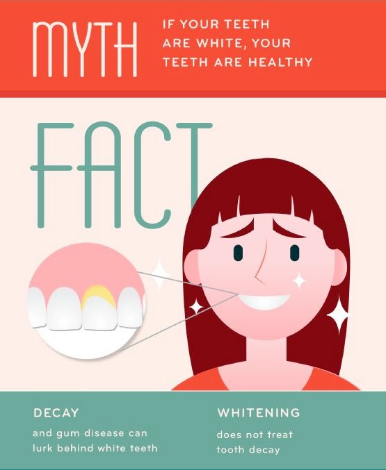 DrCranham's tweet photo. MYTH: White teeth are healthy teeth. FACT: Gum disease may be lurking behind those pearly whites. https://t.co/4Xixtpqn52