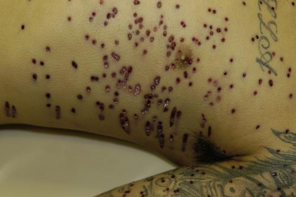Lady Da On Twitter Wow That Looks Like Buckshot Wounds I M Guessing Here But I M Sure You Let Me Know If I M Wrong