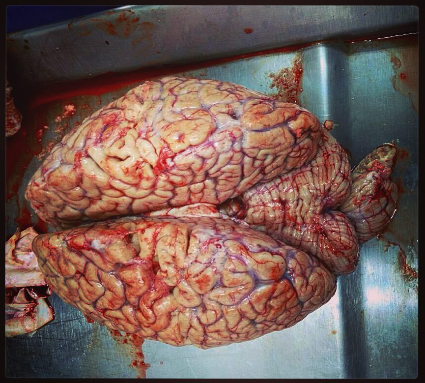 CienciasCFJP's tweet photo. #brain #use_it_its_free #medschool #medstuff #paracetamol #inner_peace #forense #aveda #sharethevibe #random #tbt #… https://t.co/lunR21wyPP