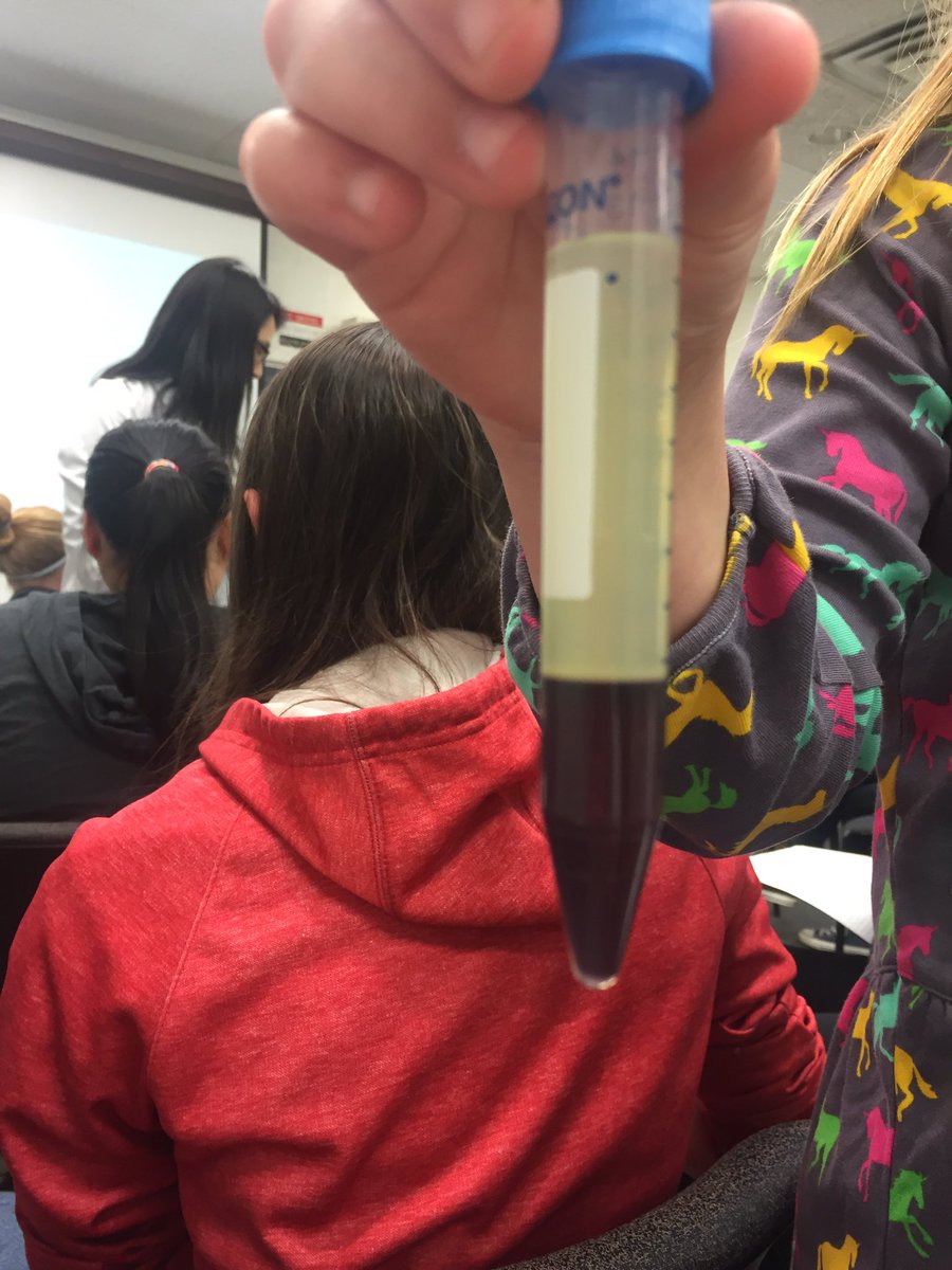 aChem2020's tweet photo. Cool blood #learning #about #clots https://t.co/TBewbvzW7r