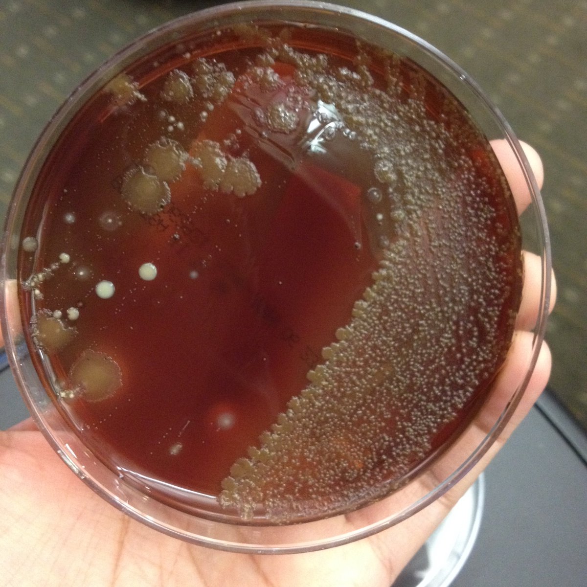 LSUHSCID's tweet photo. Neonate with fever. CSF isolates one colony of a gram positive? What do you suspect and what is the empiric therapy? https://t.co/dbJDrnmGHG