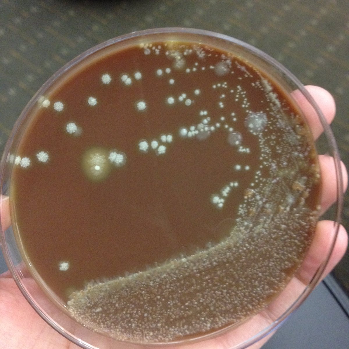 LSUHSCID's tweet photo. Neonate with fever. CSF isolates one colony of a gram positive? What do you suspect and what is the empiric therapy? https://t.co/dbJDrnmGHG