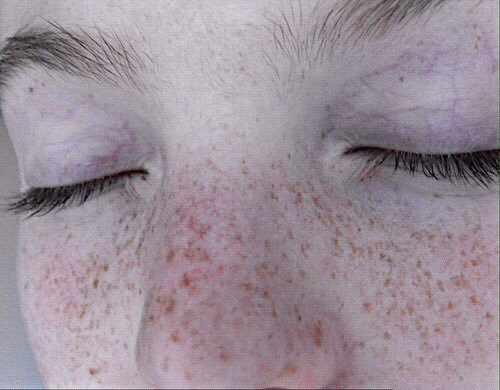 sobrredosis's tweet image. las pecas