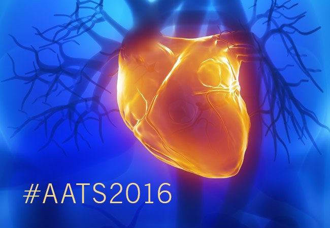 CleClinicMD's tweet photo. #AATS2016: Review of first 1,000 pts undergoing robotic mitral valve surgery, 2006-2014 @AskDrMarc @LarsSvenssonMD https://t.co/YnGNOlJ2Xn