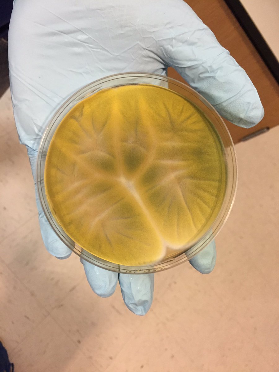 ghedinlab's tweet photo. @lauraomics is growing some gorgeous E. nidulans plates for her co-culture work! "Too pretty to throw away!" https://t.co/Rm7ADtinjc