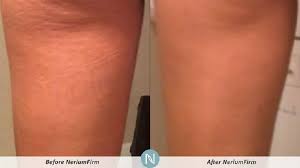 jklein86's tweet photo. Firming Body Contour Cream:Key Benefits:https://t.co/fri6qNKrfc
Smooths
Tightens
Firms
Tones https://t.co/l0P2MEl5k5