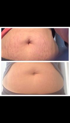 jklein86's tweet photo. Firming Body Contour Cream:Key Benefits:https://t.co/fri6qNKrfc
Smooths
Tightens
Firms
Tones https://t.co/l0P2MEl5k5