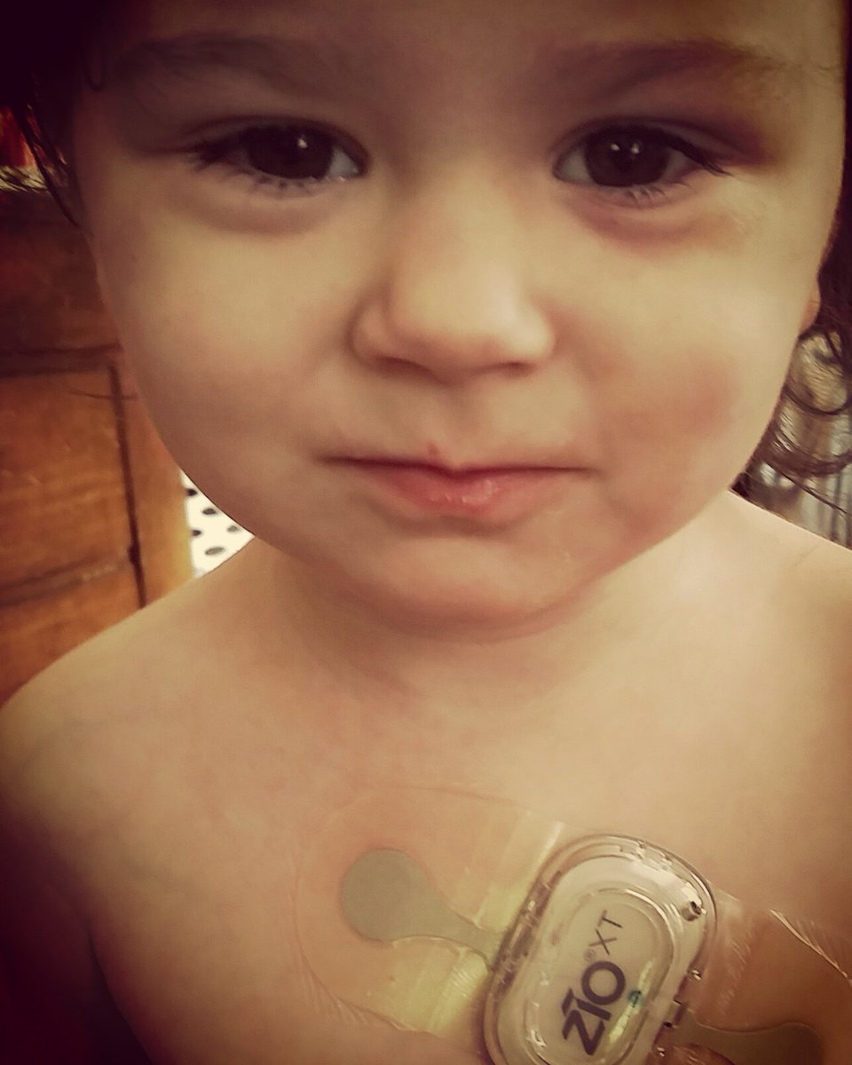TheodoraElise's tweet photo. Got a #ZioXT patch. So nice to not have cords when my heart is being monitored!
#longqt #timothysyndrome https://t.co/jJ8JkwLnSx