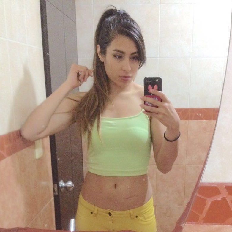 producerpassion's tweet photo. Pues sí, tengo mi cicatriz #ValRom #longhair #green #scar #musician #beauty by valin1121 https://t.co/4Feb3hYNFM