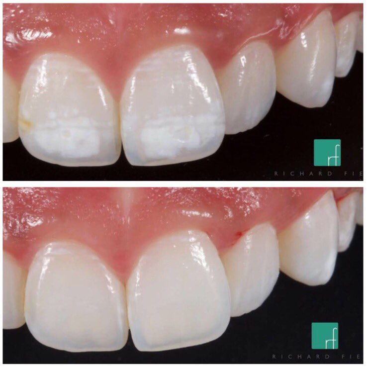 Dental Dental