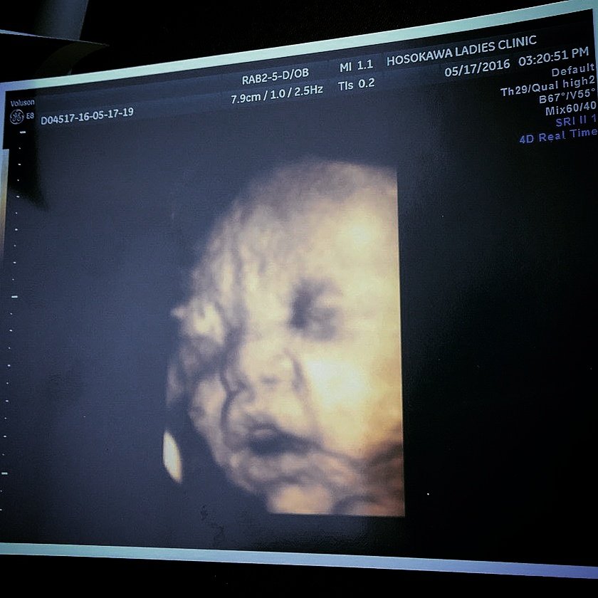 35週 Twitter Search