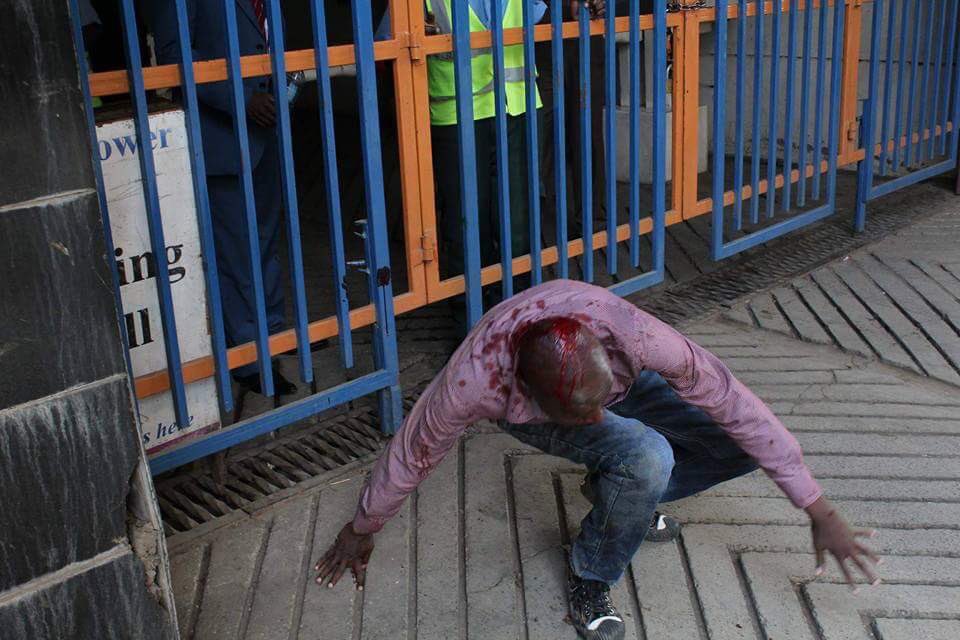 RobertAlai's tweet photo. Japheth Maroko beaten senselessly for no crime but exercising his right peacefully #IEBCMustGo #StopPoliceBrutality https://t.co/BRLvwo9FvU