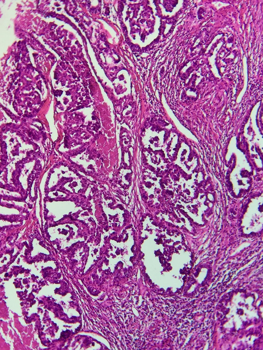 rat mesothelioma cells