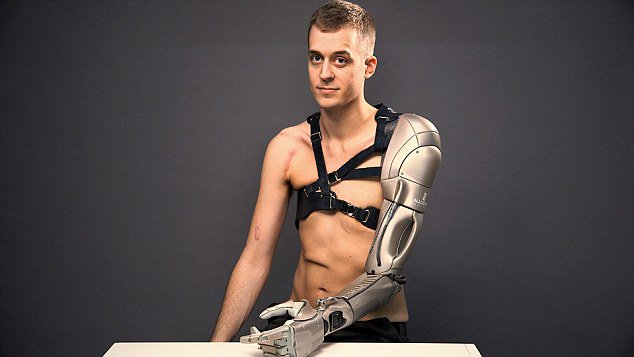 brett7three's tweet photo. 26-year-old has futuristic limb that includes phone charger, torch &amp; a drone https://t.co/iOBtsUs1Tf via @MailOnline https://t.co/1mAnDyxsId