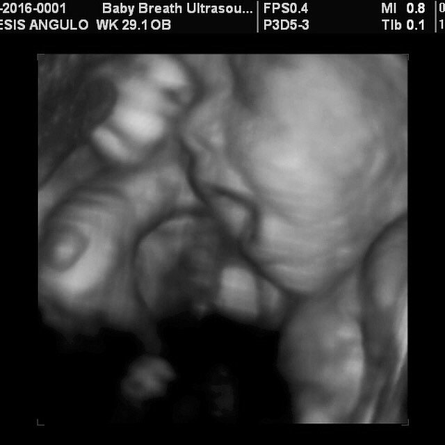 3d Baby Ultrasound breath1 Twitter