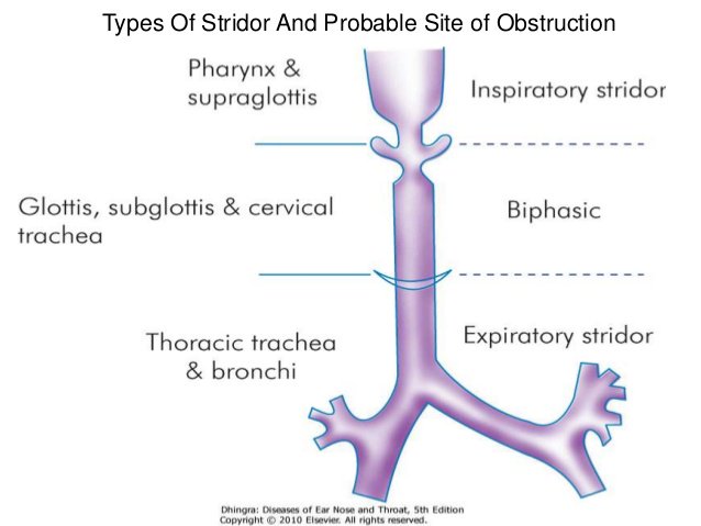 netragfoamed's tweet photo. Type of stridor by site..

#nuhnetrag https://t.co/H2xe19JFNL