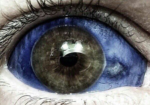 bodymodding's tweet image. 💙👀 Eye Tattoo! #tattoo #ink