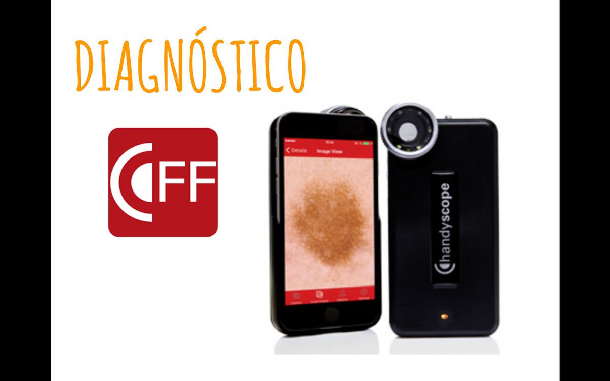 DrJordiMestres's tweet photo. #DermatoAP2016 dermatoscopio para iphone+app de gestión de imagen #handyscope. También HUD de @FirstDerm https://t.co/ahMoA50dti