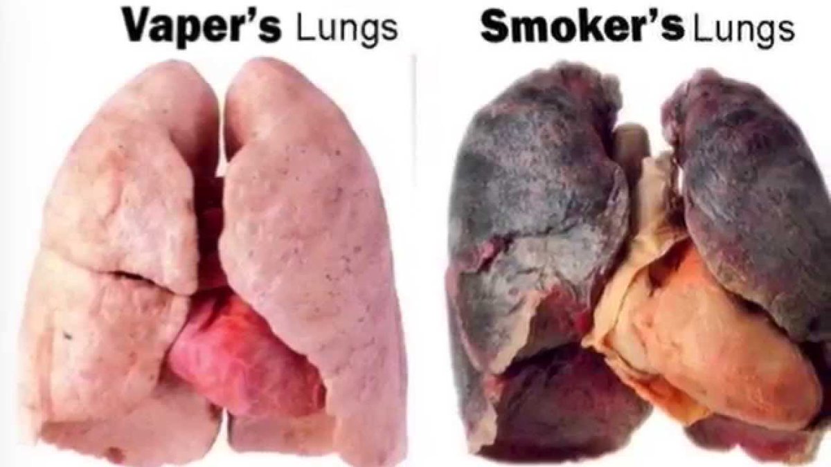 Clouds > Cancer