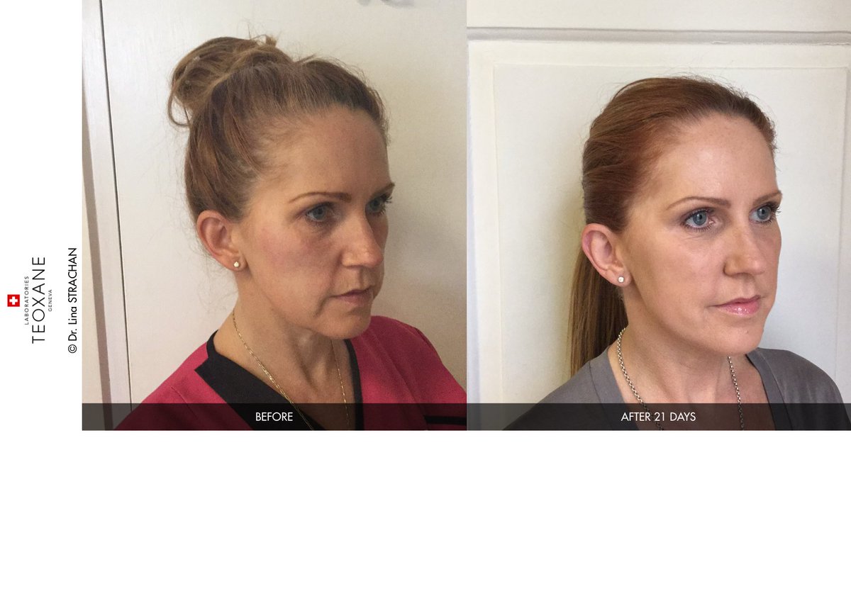 Dr Linea Medical tweet media