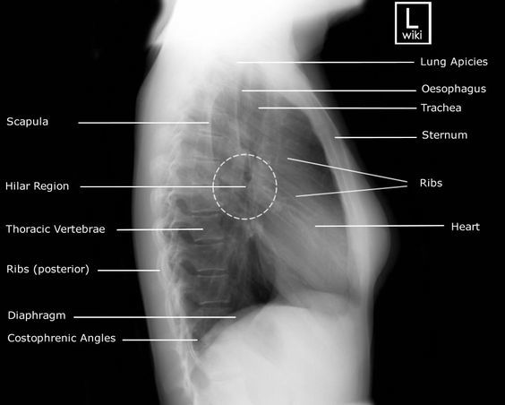 medicalce's tweet photo. Chest Radiographic Anatomy https://t.co/Uf456S4tML