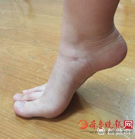 XHNews's tweet photo. Chinese girl gets popular online for having unusually long toes. Others shake hands, she can easily shake feet https://t.co/tis0R18Yzf