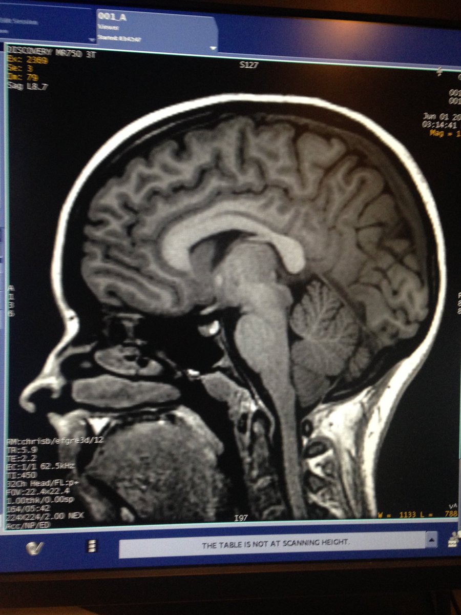 nicholas_peters's tweet photo. Hannah showing her best side. #BrainResearch https://t.co/yAop0JP1CZ