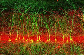JATetro's tweet image. A few slides showing how we can see neurons in 3D at #can2016. Some are simply fascinating. @CAN_ACN