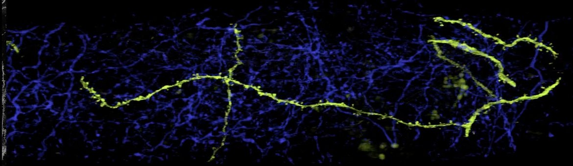 JATetro's tweet image. A few slides showing how we can see neurons in 3D at #can2016. Some are simply fascinating. @CAN_ACN
