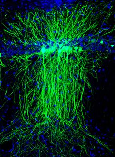 JATetro's tweet image. A few slides showing how we can see neurons in 3D at #can2016. Some are simply fascinating. @CAN_ACN
