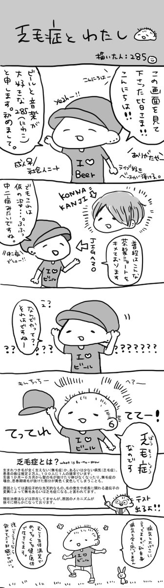mcz_158's tweet photo. 【乏毛症と私の話】
たまに「いつも髪型違いますね」っていうのはこれが理由です。
ＳＮＳに載せるか迷いましたが、せめてフォロワーさんにだけでもと思いのっけてみました。正直もう胃が痛いです。
乏毛症でなくても自分自身と戦うすべての方に。 https://t.co/pvn1Hv3SKa