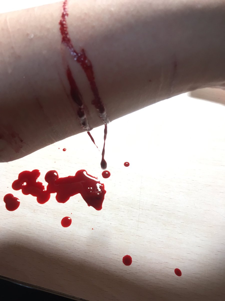 AS_2527's tweet photo. 相談に乗ってくれると嬉しいです
友達になってください。

#こんな腕でも引かないよって人RT
#病み垢さんと繋がりたい
#RTした人全員フォローする
#いいねした人全員フォローする
#リスカ https://t.co/pUVIvPivN0