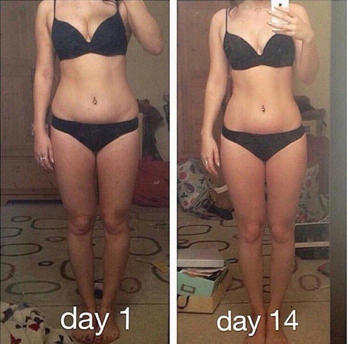 YumTeaCo's tweet photo. Results from our 14 day teatox. Order yours today &amp; start losing weight before Summer starts. 💪🏻☕️🍋 https://t.co/sLK1UQNJiZ