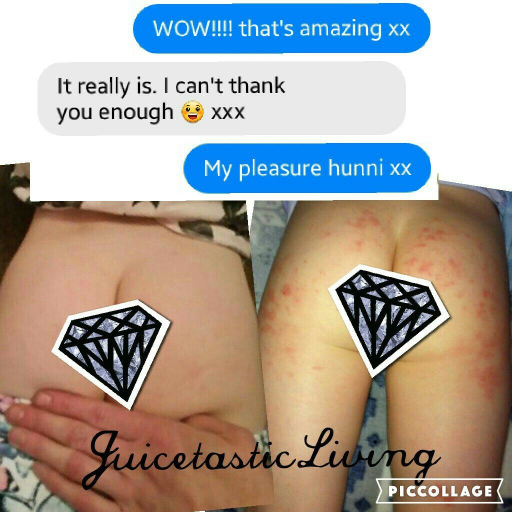 feelgoodtoday1's tweet photo. No words needed π
#Baby #Skin #Eczema #Healed #BerryCaps #Natural #Nutrition #JuicetasticLiving https://t.co/vVRqh5D7tv
