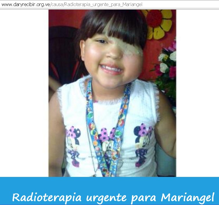 lindamama's tweet photo. Colaboren con esta hermosa niña.Necesita radioterapia: En el DAR nos encontramos todos https://t.co/uLvbWkeEE7 https://t.co/GV4QZH3eTb