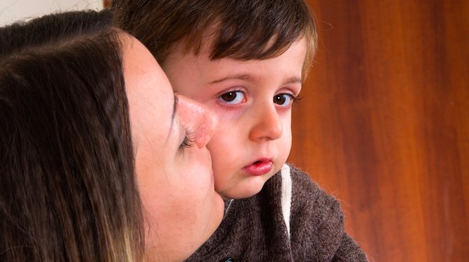 DeSpeld's tweet photo. Farmaceut koopt patent Kusje erop© van mama - Middel gaat 14000 euro per behandeling kosten https://t.co/Bq3GyOwUqS https://t.co/XSoOqeMZOW
