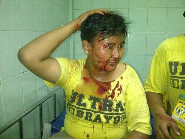 UG_Independent's tweet photo. Begini kelakuan pendukungmu???
Lepas seragammu, kami malu punya kalian!!!
@TNI_football https://t.co/69O0bfKTEW