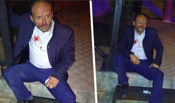 #EnsarVakfı'ndaki Dinci Sapıklar Tarikatını Haber Yapan Medyatürk Gazetesi Sahibi Hakan Koruk'a AKP'liler Saldırdı.
