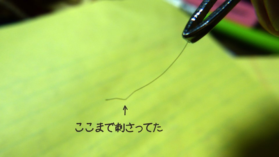 にゃー 足の裏にとげが刺さった とおもいきや 刺さってたのは自分の髪の毛 あんな細くやわらかなものがどうやって分厚い足 の裏に刺さるのか 信じられん奇跡ｗ どのぐらいの角度と力で刺さるのだろうね １枚目 数年前 ２枚目 昨日