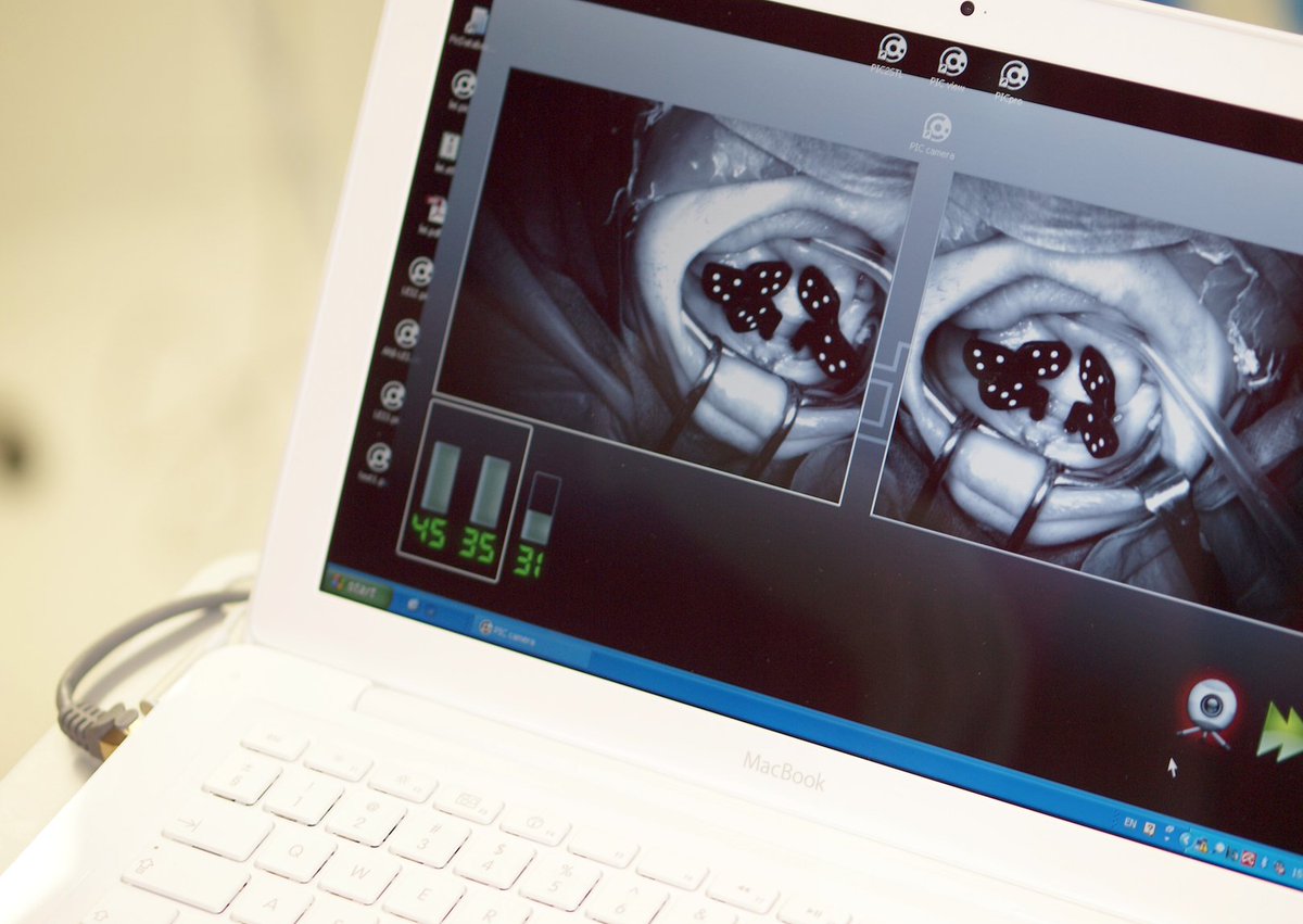 PICdental's tweet image. Ponemos a tu alcance la mejor #tecnología de #implanto-prótesis ¡Compruébalo! buff.ly/1Rkneb7 #clinica