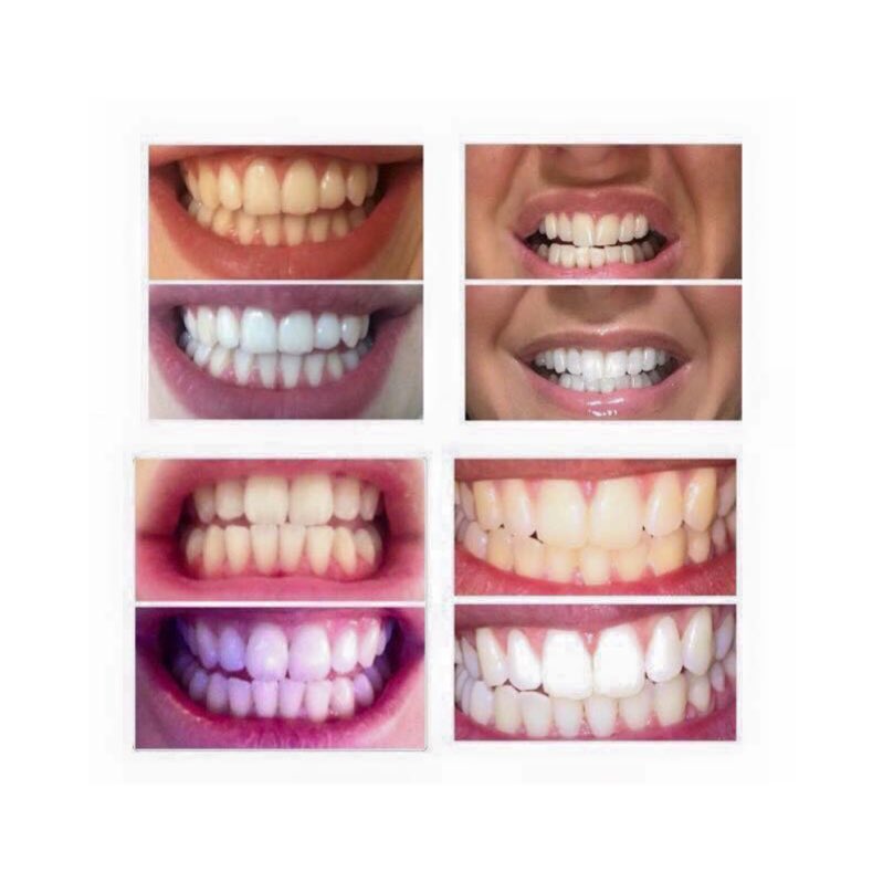 AliceTTransform's tweet photo. 🌟Whitening toothpaste 🌟Brightens and whitens teeth while fighting plaque formation. 💎 https://t.co/7ZLqBbftys
